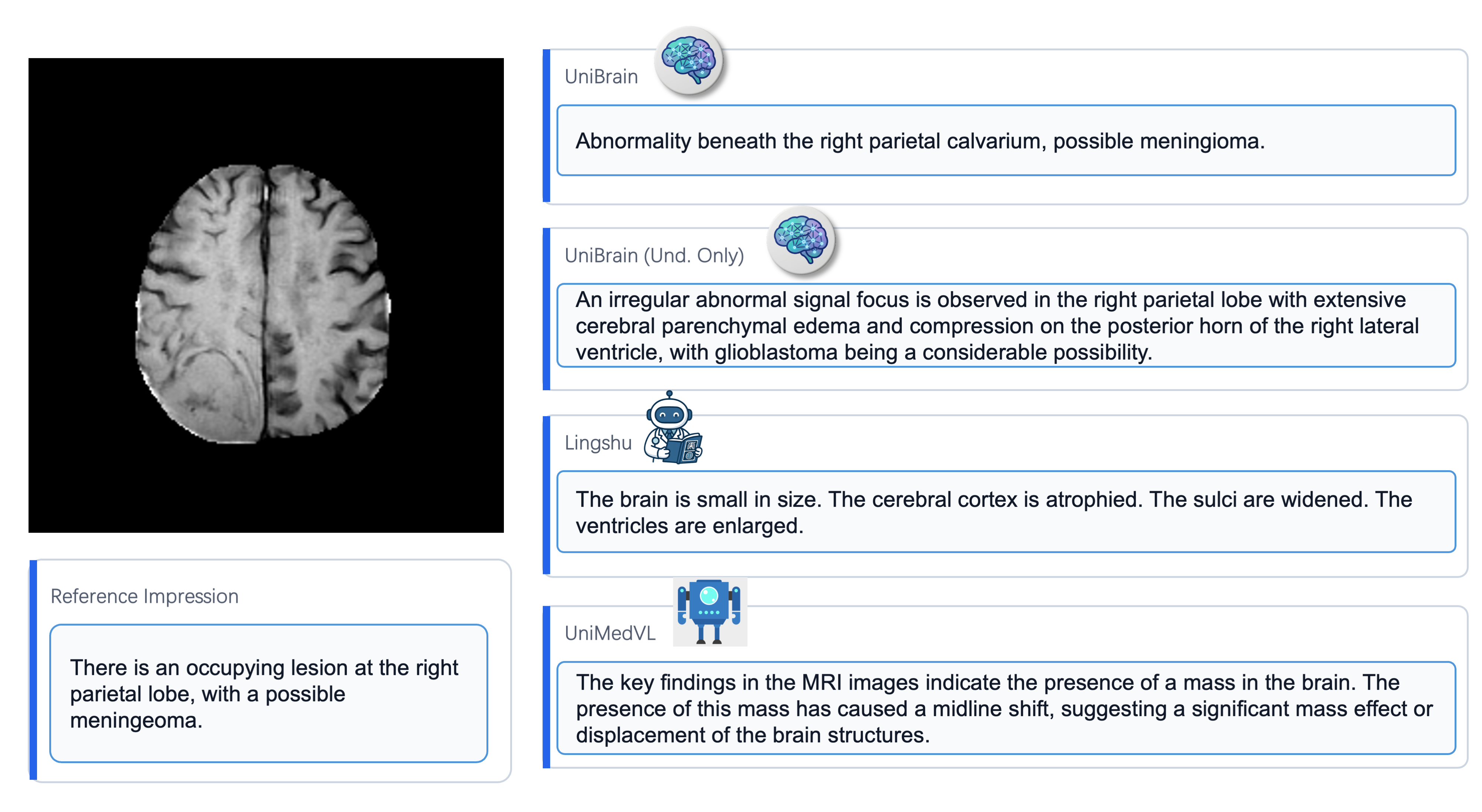MRI diagnosis and report generation results