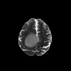 UniBrain