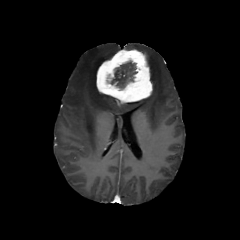 UniBrain