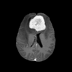 UniBrain Gen