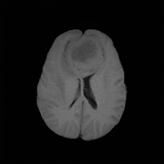 UniMedVL