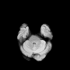 UniBrain Gen